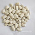 Wholesale Yunnan Large White Kidney Beans